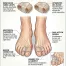 Bunion & Hammer Toe Spacer